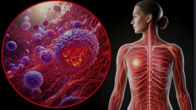 Photo of हाई-फैट कीटो डाइट बढ़ा सकती है ब्रेस्ट कैंसर का खतरा