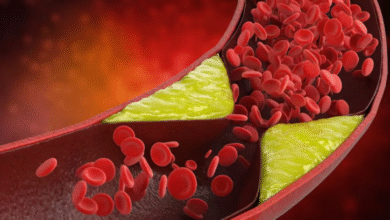 Photo of जीन एडिटिंग थेरेपी से खराब कोलेस्ट्रॉल में आएगी कमी