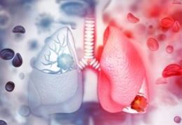 Photo of जहरीली हवा से बढ़ रहा फेफड़ों की इस गंभीर बीमारी का खतरा